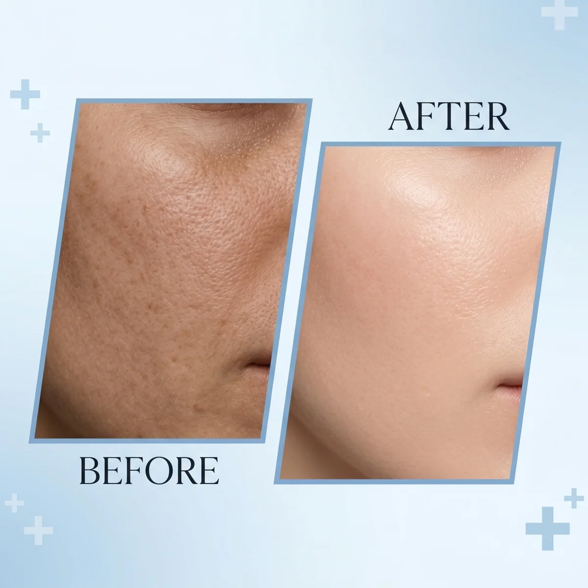 Oxygenizer - Best Skin Whitening Night Cream - Image 2